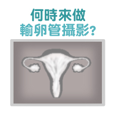 何時該做輸卵管攝影?