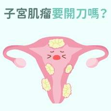 子宮肌瘤要開刀嗎?