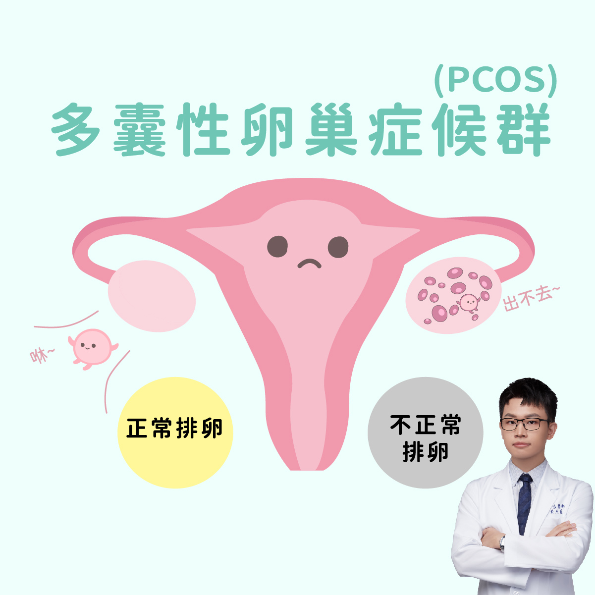 多囊性卵巢症候群（PCOS）